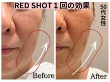 エトワール(etoile)/初めてのレッドショット☆