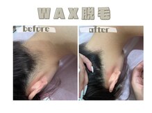 レヴィート(Revept)/【ワックス脱毛】