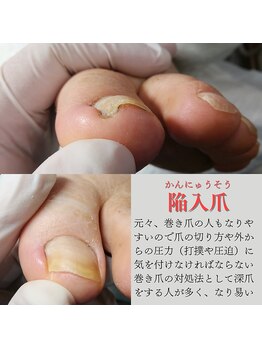 《施術不可能な場合の参考例》