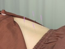 梅沢鍼灸院/しばし時間を置く