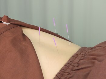 梅沢鍼灸院/しばし時間を置く