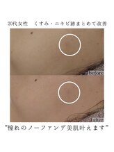 ヴェルシック(Belchic)/くすみのない明るいお肌へ