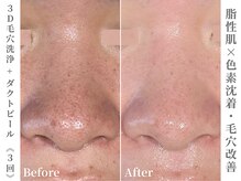 肌が変わる、変化を実感できるサロン。メンズもお任せください☆