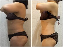 美容整体ウェリナ 中川八田院/小顔矯正/骨盤矯正/美脚サロン