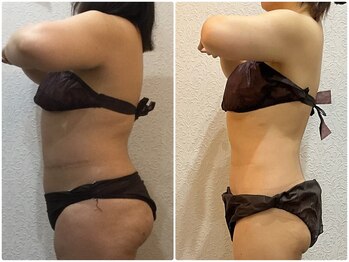 美容整体ウェリナ 中川八田院/小顔矯正/骨盤矯正/美脚サロン