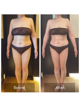 ウノジェンネ UNO DJENNE/たった4.5ヶ月で目標の－10kg超!