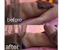 イーリバイブ/iNVYDOM MAX