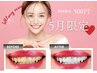 【5月限定！！夏までに白い歯へ☆】最新ホワイトニング9分×2 ¥5,980→¥500