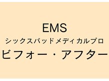 岡町おうち鍼灸整骨院/EMS　ビフォー・アフター