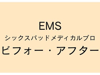岡町おうち鍼灸整骨院/EMS ビフォー・アフター