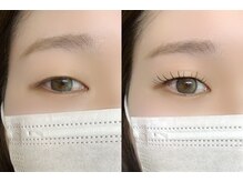 アイビー(eyebee)/アンドヘルシー