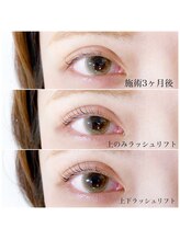 ネイル アンド アイラッシュ グレイス(Grace)/上下ラッシュリフト