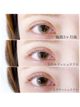 ネイル アンド アイラッシュ グレイス(Grace)/上下ラッシュリフト