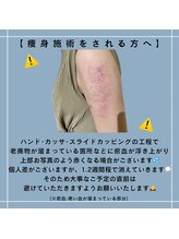 ボヌール 久留米(Bonheur)/痩身注意事項