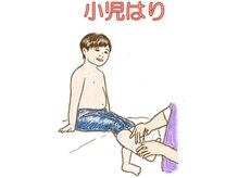 かつらはりきゅう 小児しん/小児はりもやっています。
