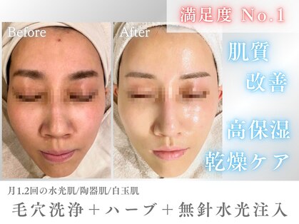 ドクターエイチ 梅田本店(Doctor.H)の写真