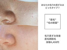 アンシャンテ 神戸元町店(Enchante)/肌質改善ピーリングフェイシャル