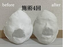 コルギサロン 伏見店(k_korugi.salon)/コルギ4回目のお客様！！