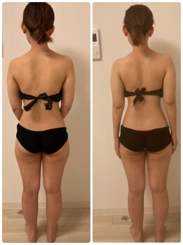 アルストロメリア 埼玉店/お施術ビフォーアフターです。