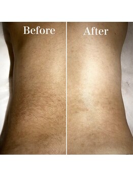 ミーエイト(Mii∞)/《背中Before/After》