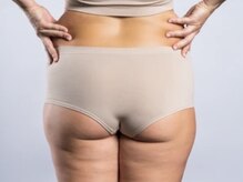 ルーナ(Runa)/ぞっとするうしろ姿ケア