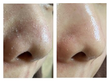 ケアナケア 守谷/たった１回で変化！ご新規様限定