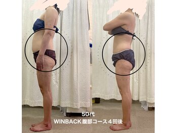 エステサロン クレイドルフェザー