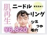 【シミ肝斑ケア＋毛穴レス】　肌を育てるピーリング　14900円→6820円　
