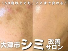 ビュキュア