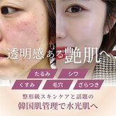 エミニナル(EMININAL)