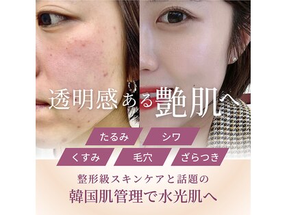 エミニナル(EMININAL)の写真