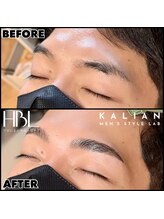 カリアン(KALIAN)/HBL＋高濃度トリートメント