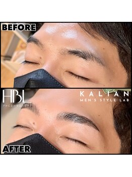 カリアン(KALIAN)/HBL＋高濃度トリートメント