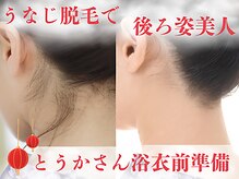 ビースキン 広島(BE:SKIN)