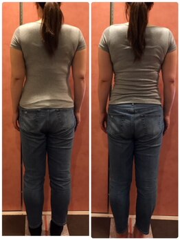 サロンサンティ/バザルトストーン背中ウエスト