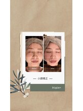 デジックスプラス(Digix+)/【小顔】