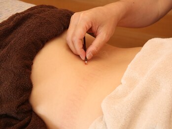 ムスビ(musubi)/よもぎのお灸でピリっ刺激の温活