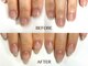 ネイル アンチュ(Nail Anchu)の写真