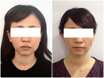 美容整体ウェリナ 中川八田院/小顔矯正/骨盤矯正/美脚サロン