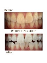 ホワイトニングショップ 四条店/