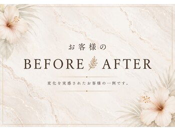 ヨサパーク メンソーレ(YOSA PARK)/Before after
