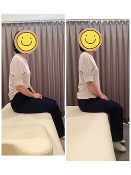 いおり骨盤整体 リブート(RE:BOOT)/姿勢矯正ビフォーアフター