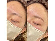 ビューティサロン ソル(Sol)/眉デザイン