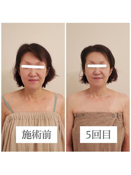 エクラ(eclat)/お客様の変化