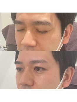 眉毛の王様 神戸三宮店/お客様の施術例【神戸/三ノ宮】