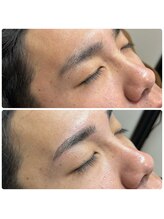 リット 広島並木通り(Lit)/美眉 ハリウッドブロウリフト