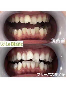 ルブラン 奈良店(Le Blanc)/同時照射可能です◯