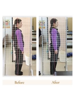 ストレッチヒーロー 倉敷中庄店/立ち姿勢のビフォーアフター