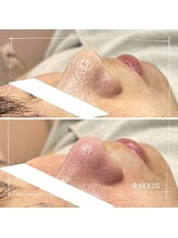 ネクサス(NEXUS)/鏡越しの自分が嫌い？