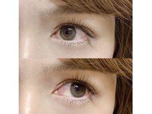 アイウィッシュ(EyeWish)